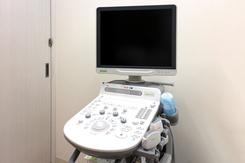 超音波診断装置